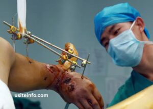 Wellhealthorganic Surgery for Wrist and Ankle Injuries