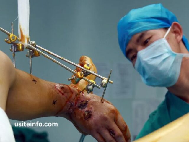 Wellhealthorganic Surgery for Wrist and Ankle Injuries